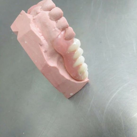 Ángel Dueñas Laboratorio Dental prótesis dental 5