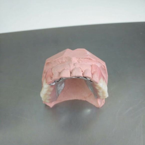 Ángel Dueñas Laboratorio Dental prótesis dental 6