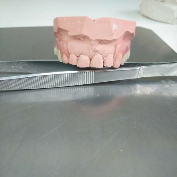 Ángel Dueñas Laboratorio Dental prótesis dental 1
