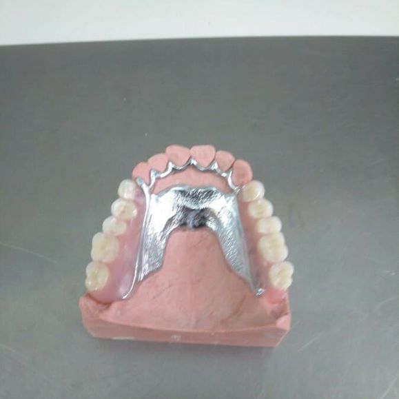 Ángel Dueñas Laboratorio Dental prótesis dental 4