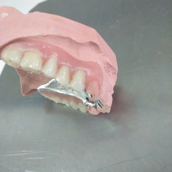Ángel Dueñas Laboratorio Dental prótesis dental 3