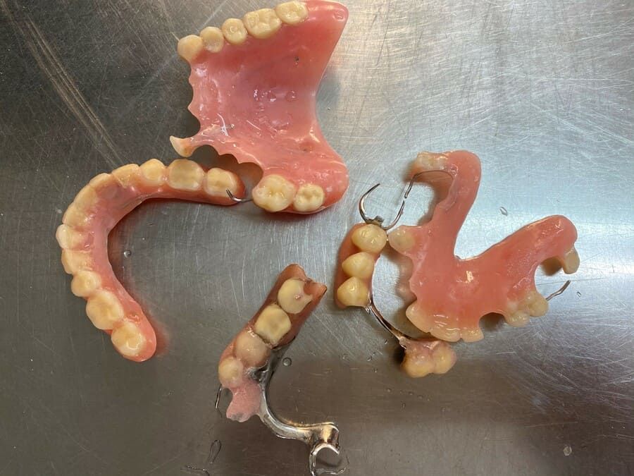 Ángel Dueñas Laboratorio Dental prótesis dental 2