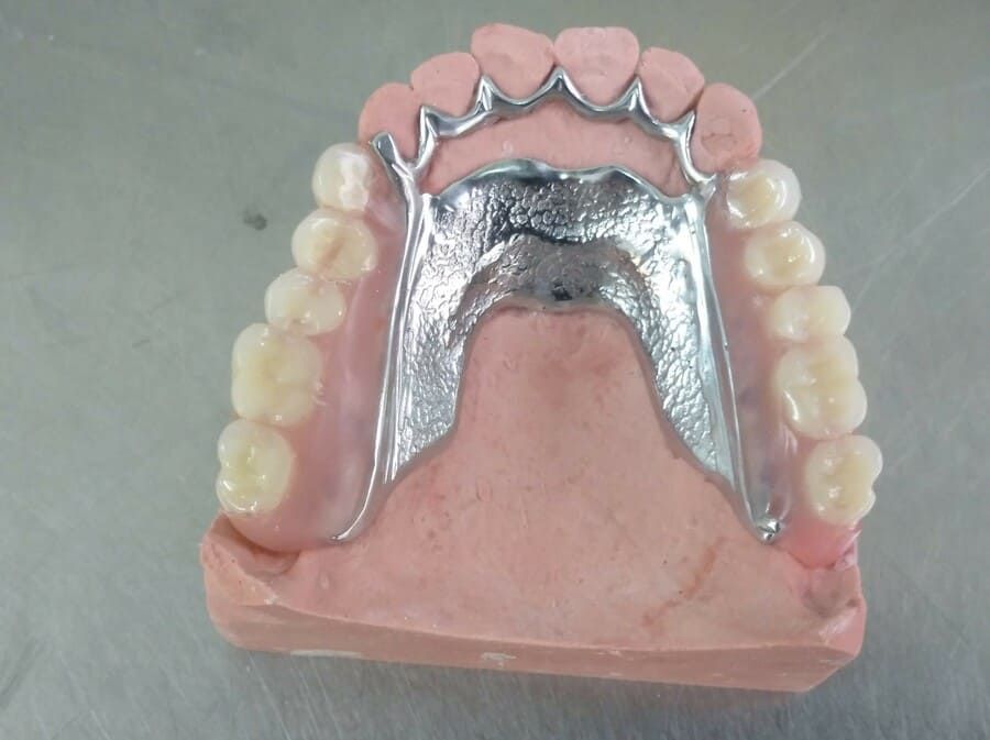 Ángel Dueñas Laboratorio Dental prótesis dental 9