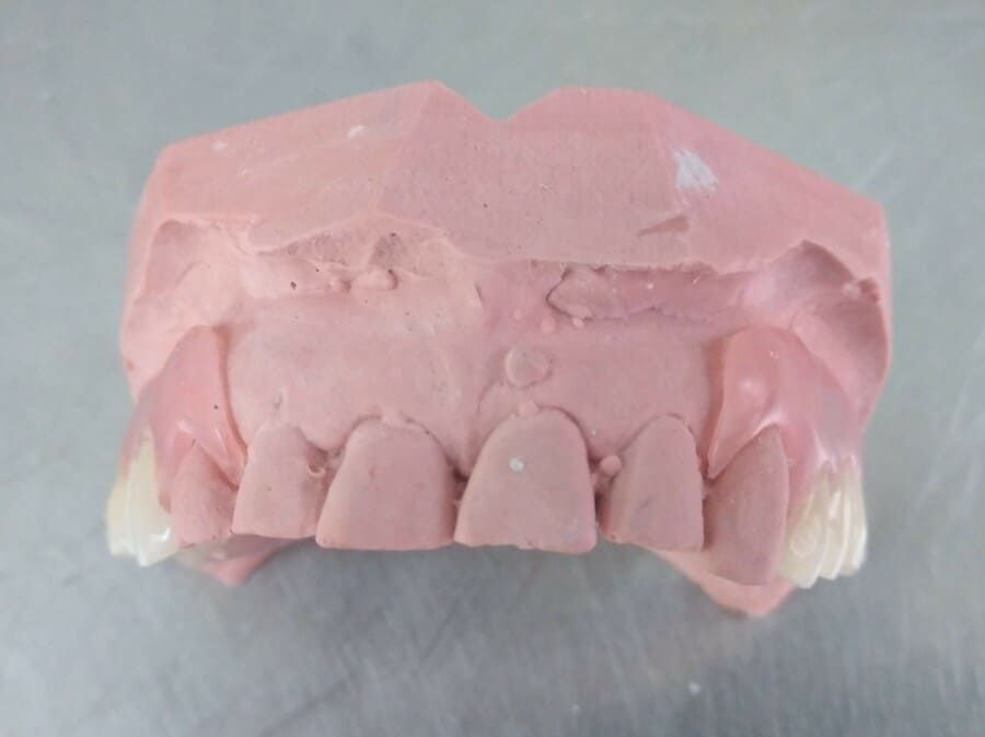 Ángel Dueñas Laboratorio Dental prótesis dental 7